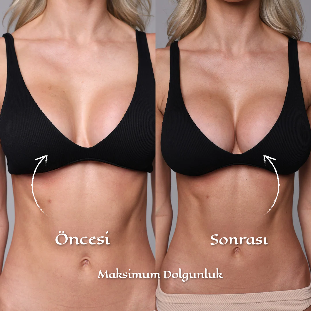 Görünmez Push-Up Ped – Sütyensiz Doğal Destek